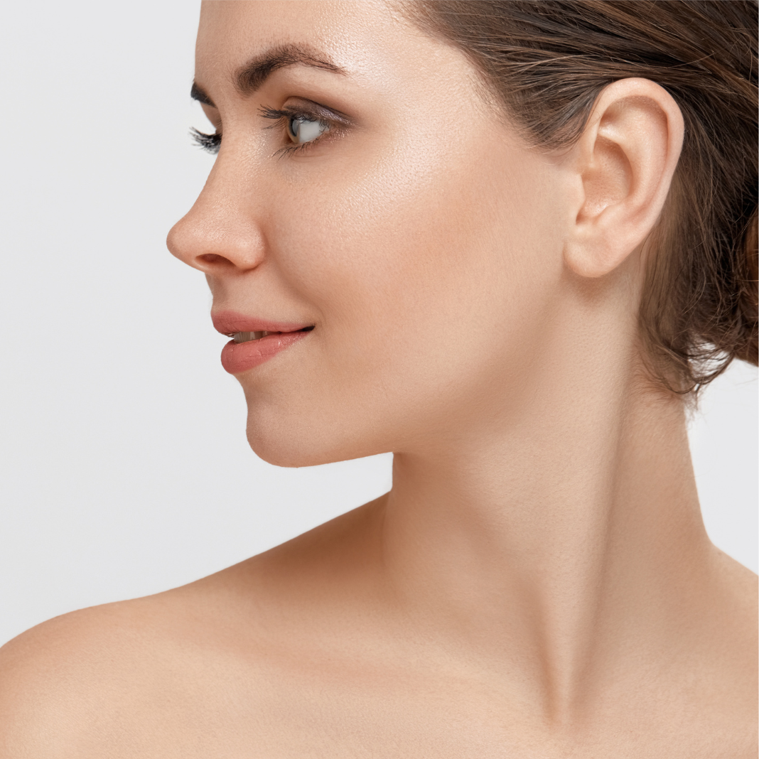 Treatment Areas Dermal Filler