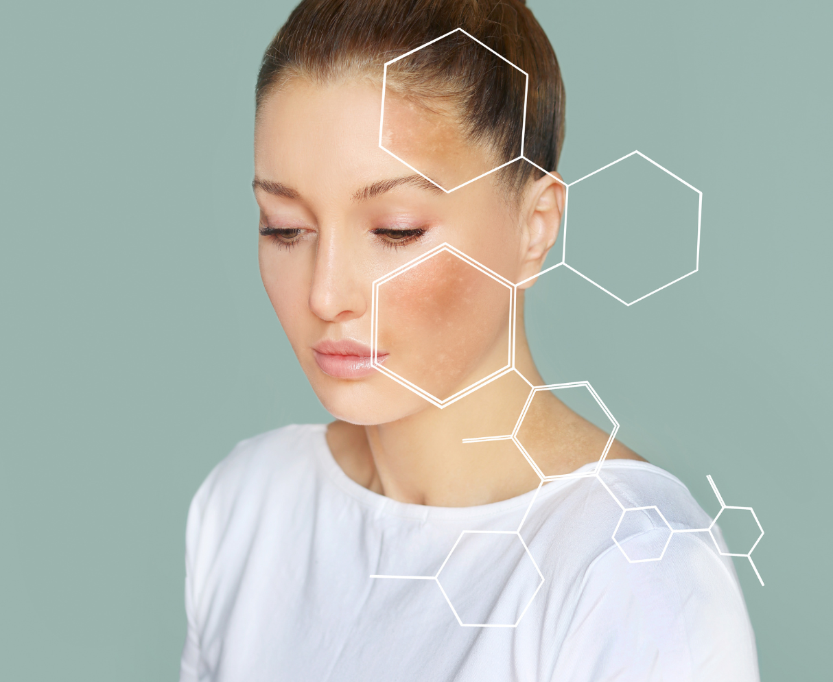 Dermal Filler Treatment in Leeds